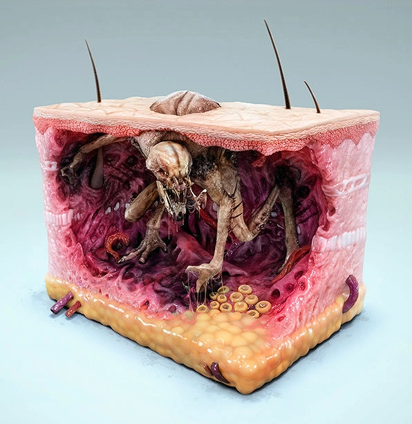 znamiona skóry jako potwory